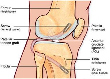 knee replacement doctor in Kolkata